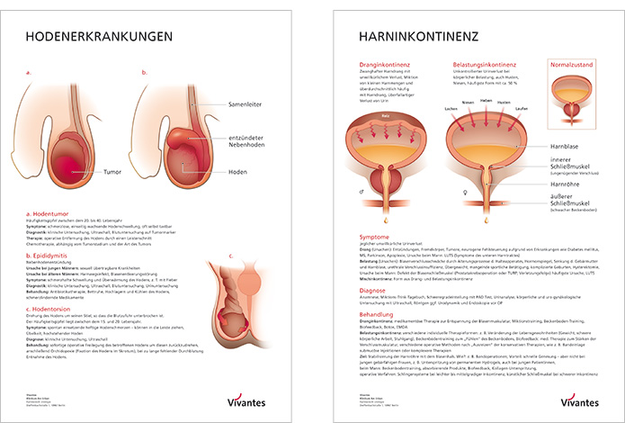 plakate-medizin-grafik-illustrationen-visuelle-wissenschaftskommunikation-urologie-ausstellung